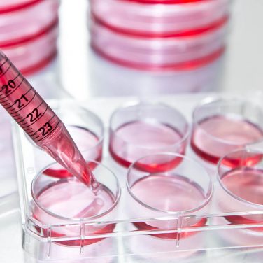 Subculture, Researcher transfer mammalian cells from a previous culture to fresh growth medium to increase the cell number