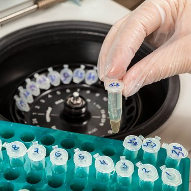 Charging a centrifuge with samples. Gloved hand holds an Eppendorf test-tube with a sampled muscular tissue. A part of DNA extraction procedure